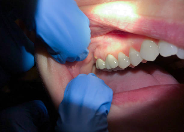 Best After-Hours Dental Trauma Care in Mcdonald, PA
