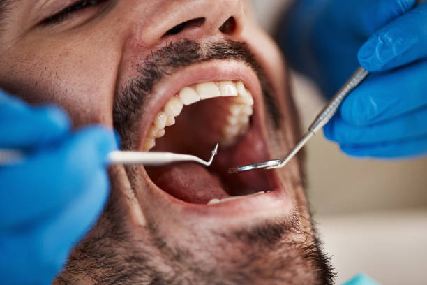 Best Emergency Tooth Extraction in Mcdonald, PA